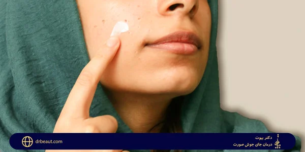 Facial-acne-treatment