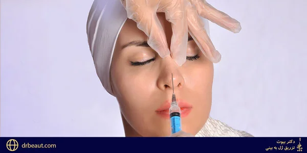 Injection-of-gel-into-the-nose