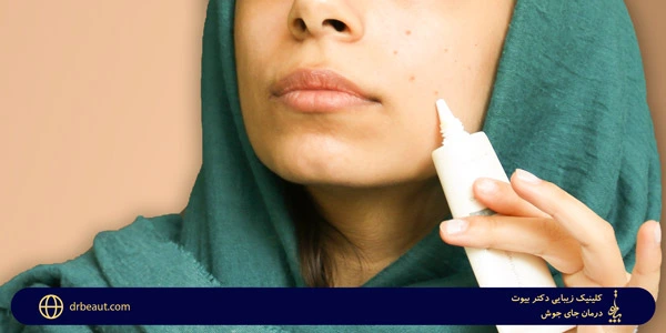 Treatment-of-boils