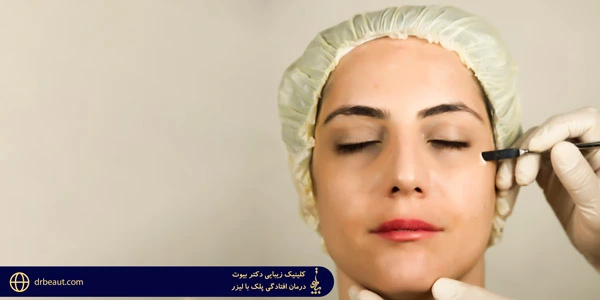 Treatment-of-drooping-eyelids-with-laser