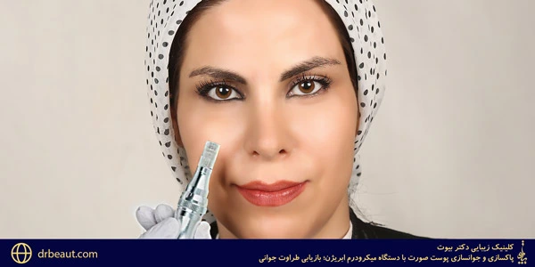 Cleansing-and-rejuvenating-the-facial-skin-with-microderm-abrasion-device-Restore
