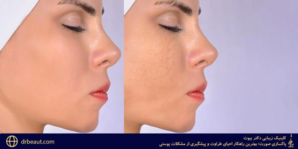 facial-cleansing-The-best-way-to-restore-freshness-and-prevent-skin-problems