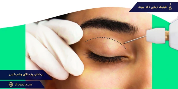 Removing-puffiness-above-the-eye-with-laser