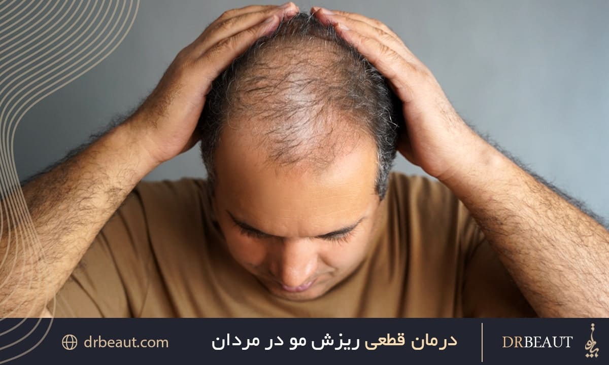 درمان قطعی ریزش مو در مردان با استفاده از روش‌ها و علم نوین

