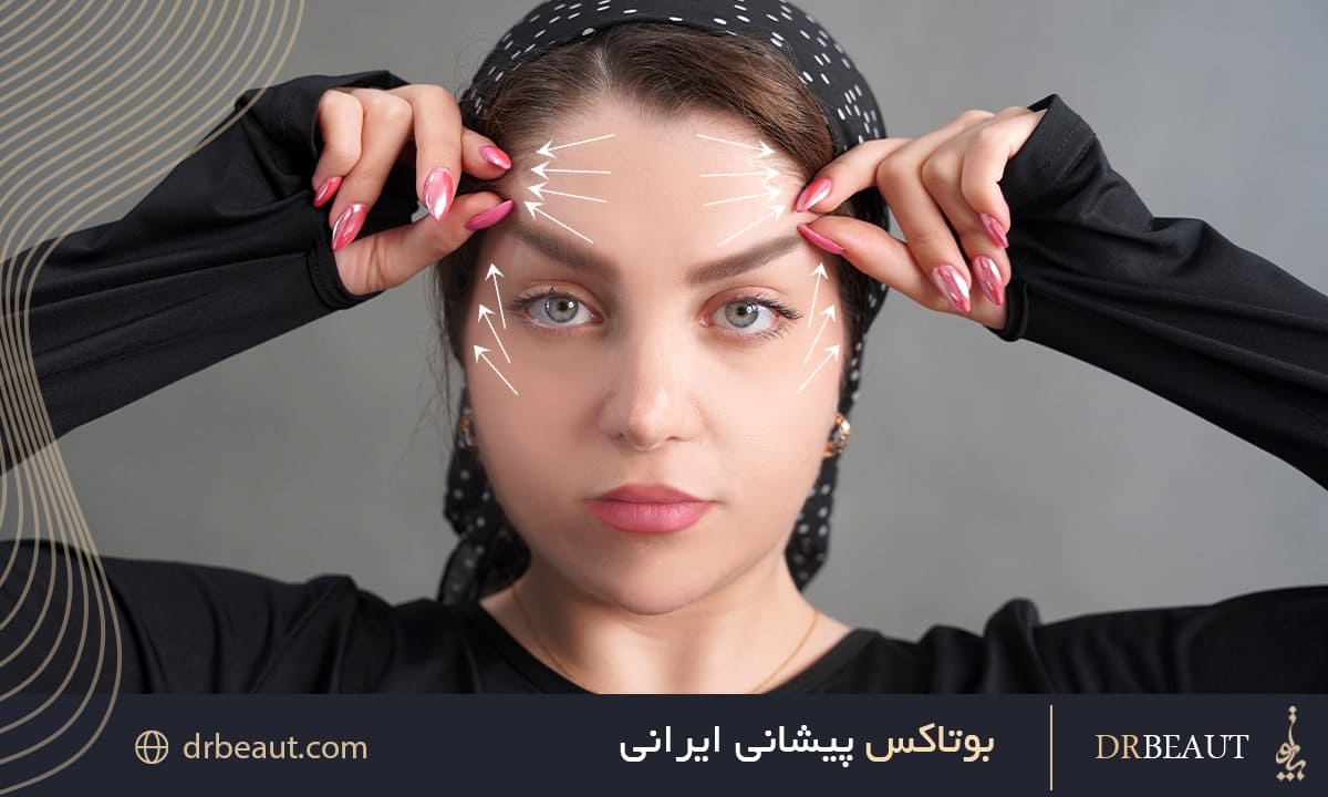 بوتاکس پیشانی ایرانی