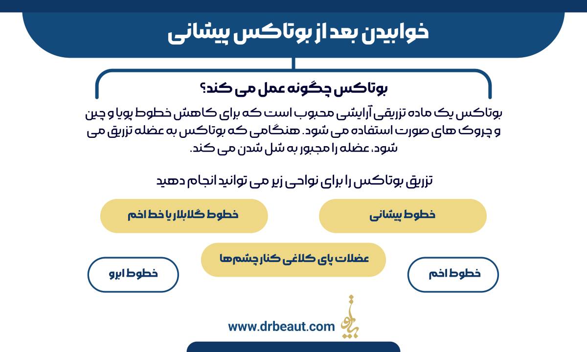 خوابیدن بعد از بوتاکس پیشانی