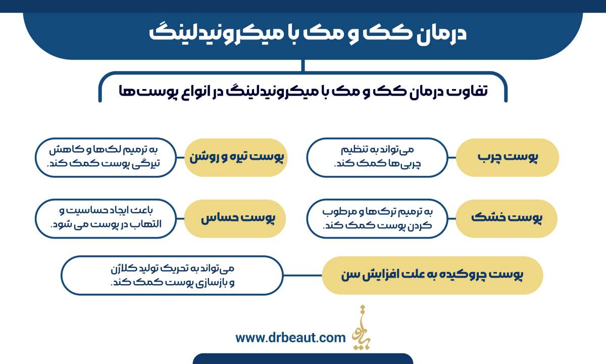 درمان کک و مک با میکرونیدلینگ