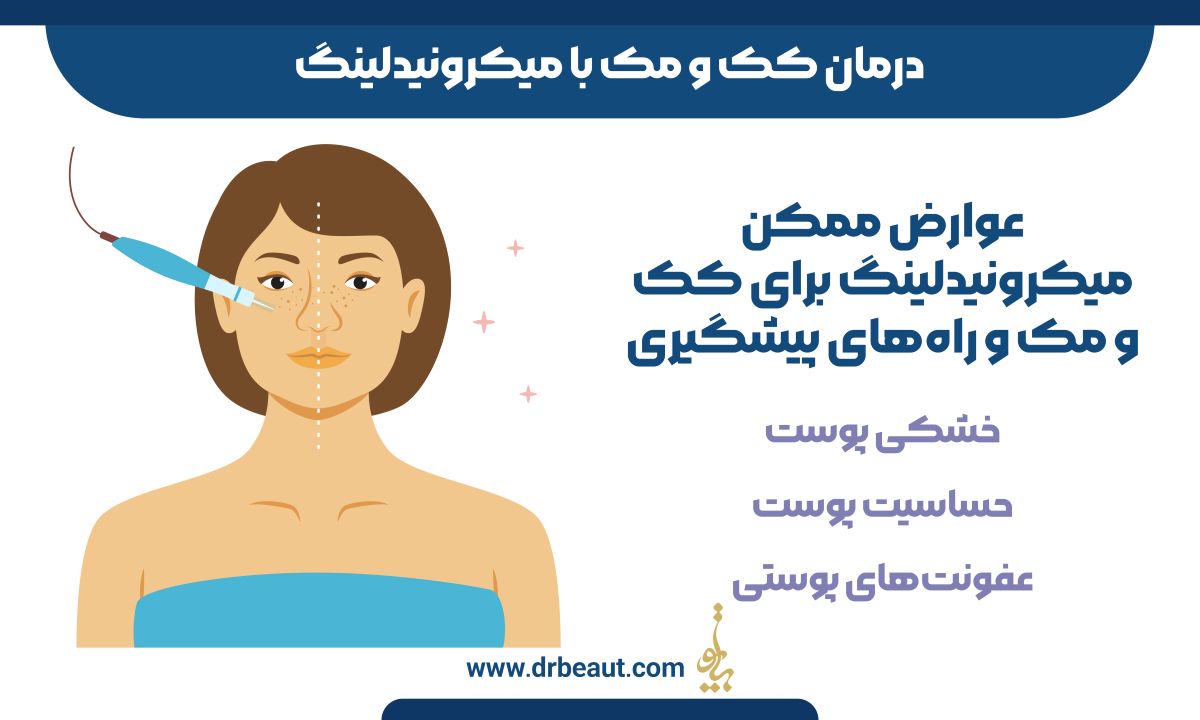 درمان کک و مک با میکرونیدلینگ