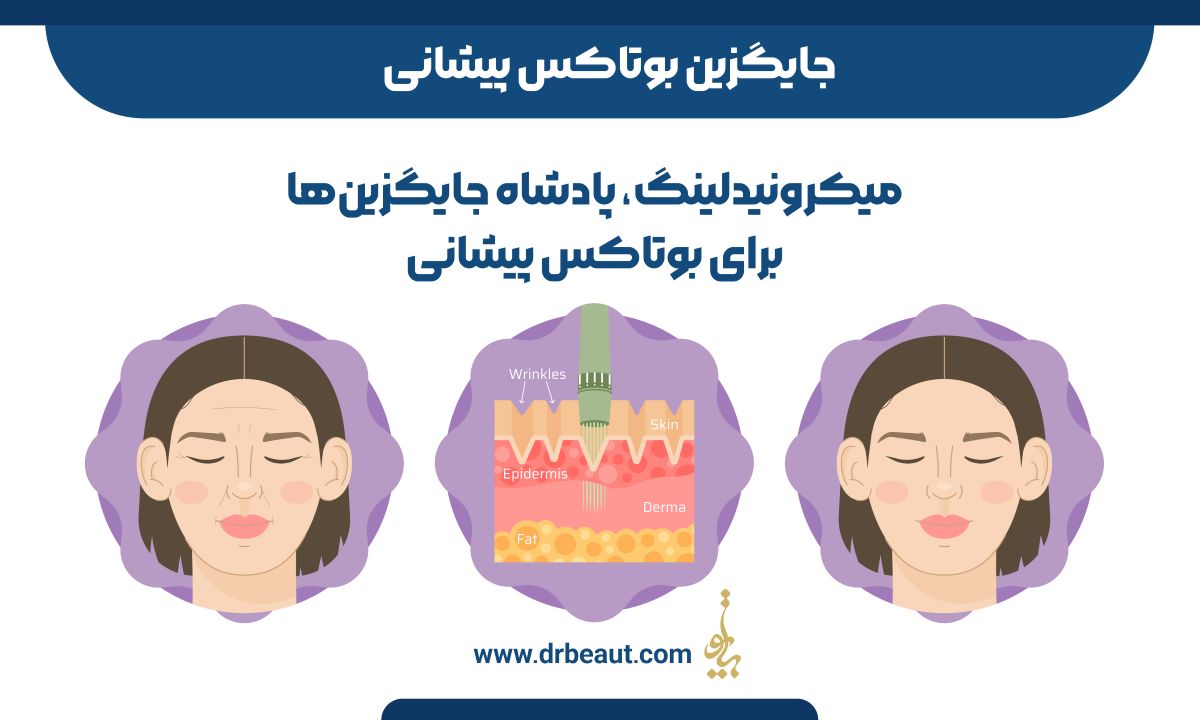  فواید و خطرات جایگزین‌های بوتاکس پیشانی که باید بدانید

