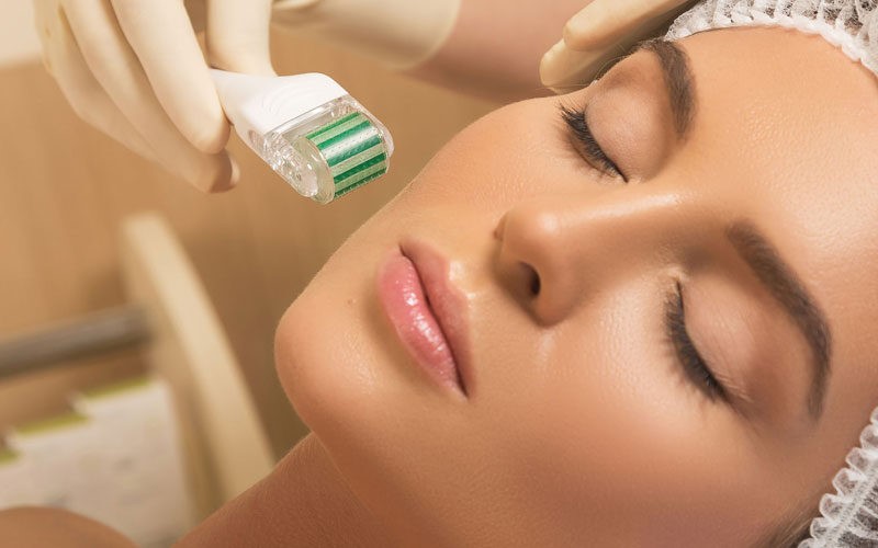 لیزر بهتر است یا میکرونیدلینگ؟ مقایسه دو روش
